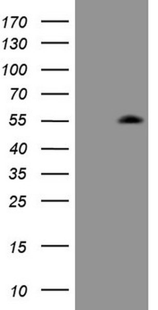 ZIC3 Antibody in Western Blot (WB)