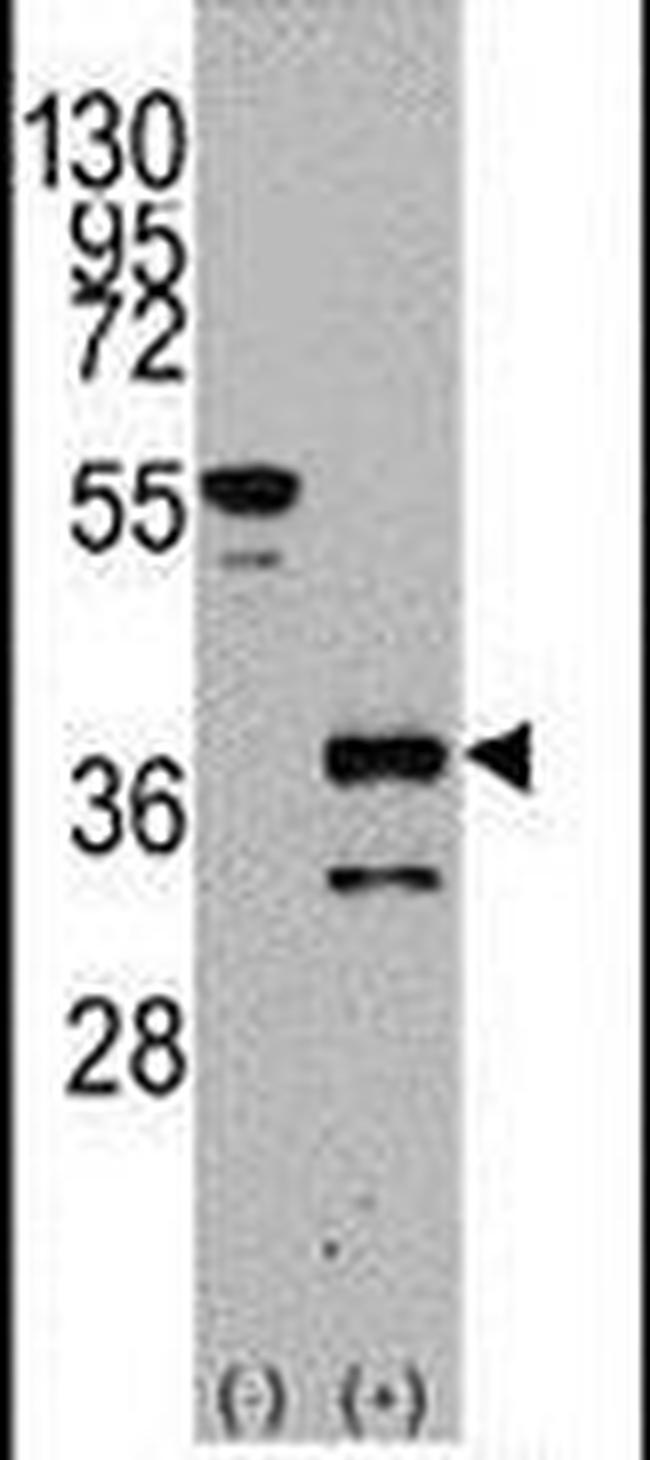 ZIC4 Antibody in Western Blot (WB)