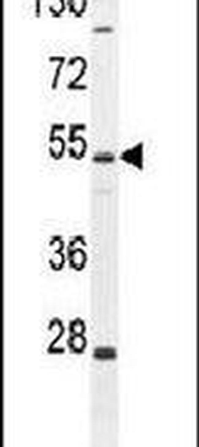 ZIK1 Antibody in Western Blot (WB)