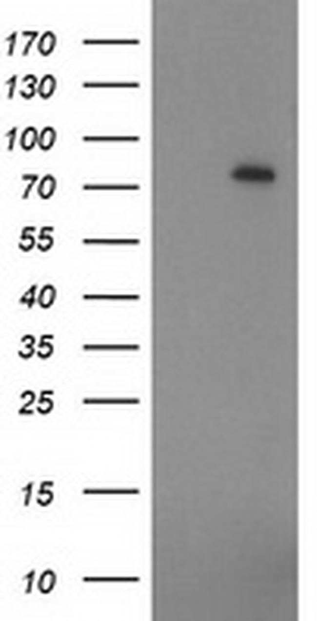 ZIM2 Antibody in Western Blot (WB)