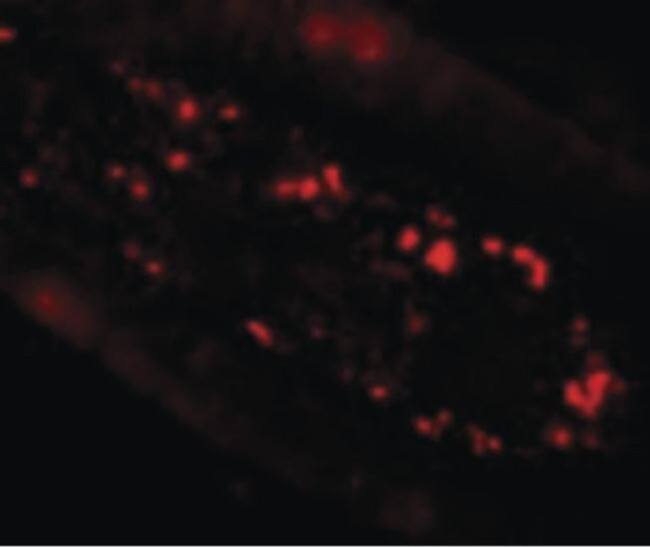 SLC39A4 Antibody in Immunocytochemistry (ICC/IF)