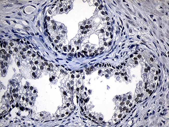 ZKSCAN1 Antibody in Immunohistochemistry (Paraffin) (IHC (P))