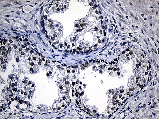 ZKSCAN1 Antibody in Immunohistochemistry (Paraffin) (IHC (P))