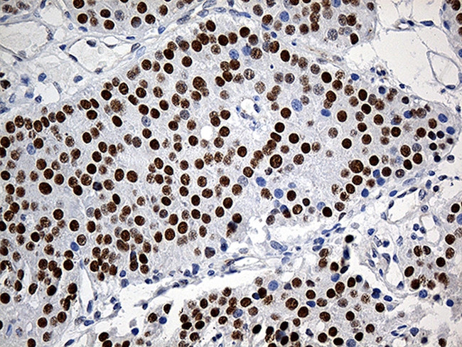 ZKSCAN1 Antibody in Immunohistochemistry (Paraffin) (IHC (P))