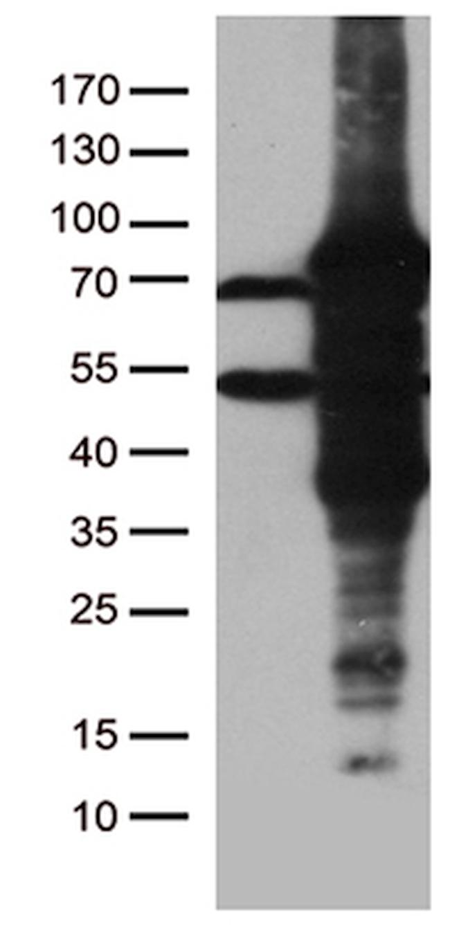 ZKSCAN1 Antibody in Western Blot (WB)