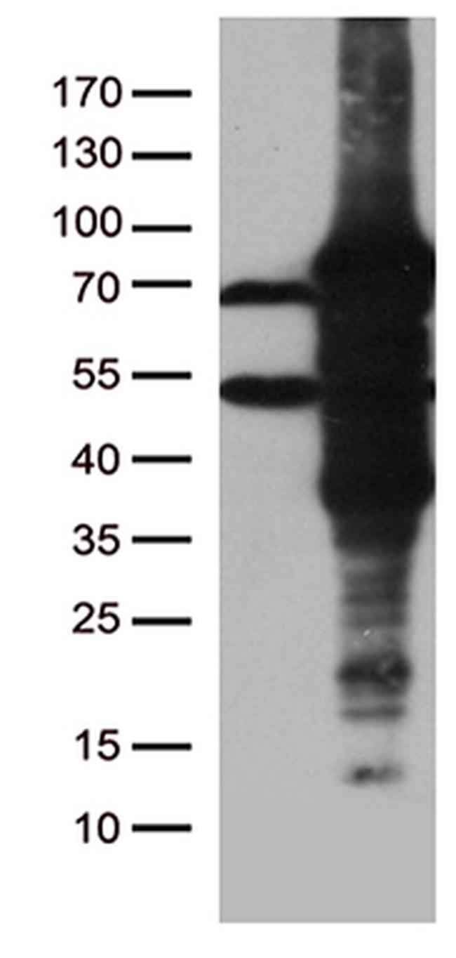 ZKSCAN1 Antibody in Western Blot (WB)