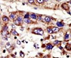 ZMPSTE24 Antibody in Immunohistochemistry (IHC)