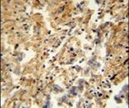 ZMYND10 Antibody in Immunohistochemistry (IHC)