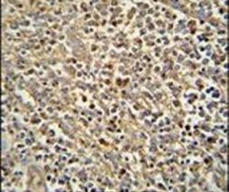 ZNF180 Antibody in Immunohistochemistry (IHC)