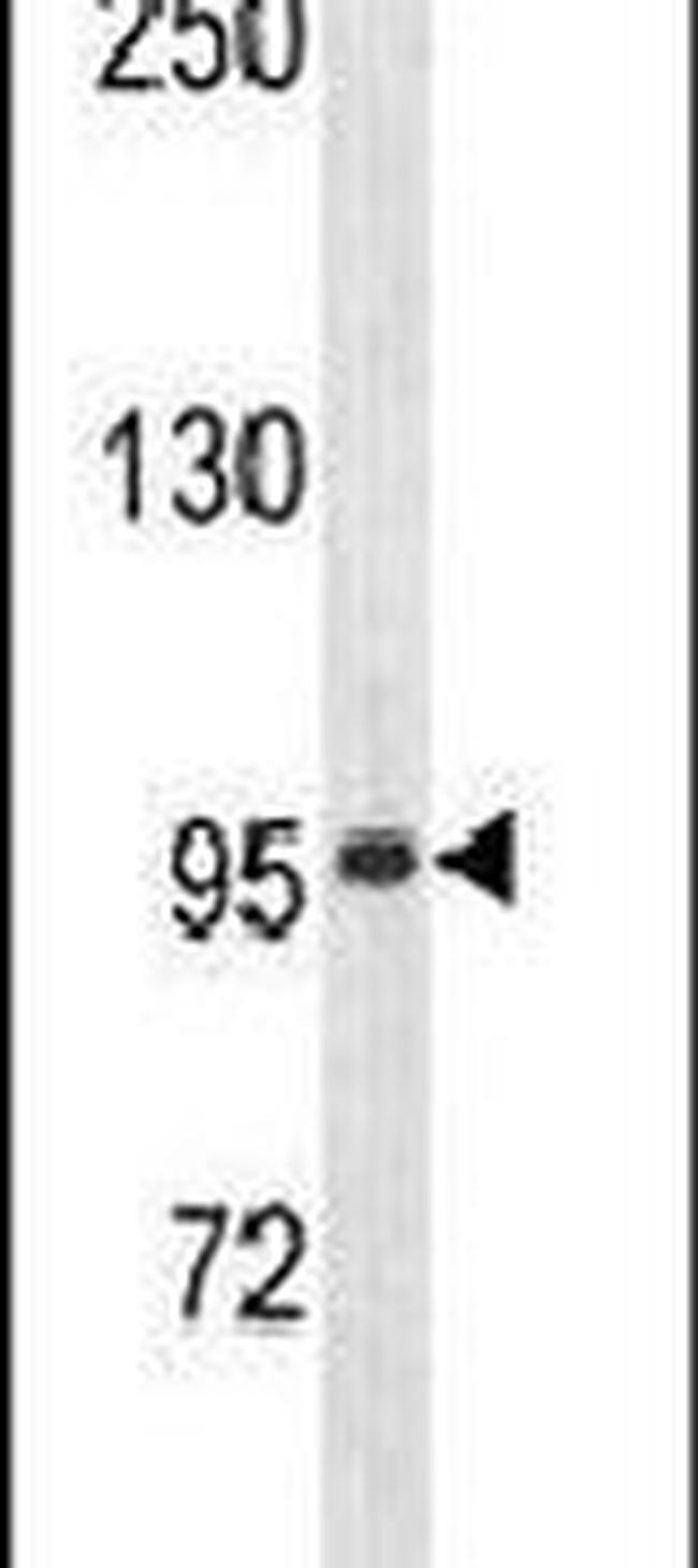 ZNF473 Antibody in Western Blot (WB)