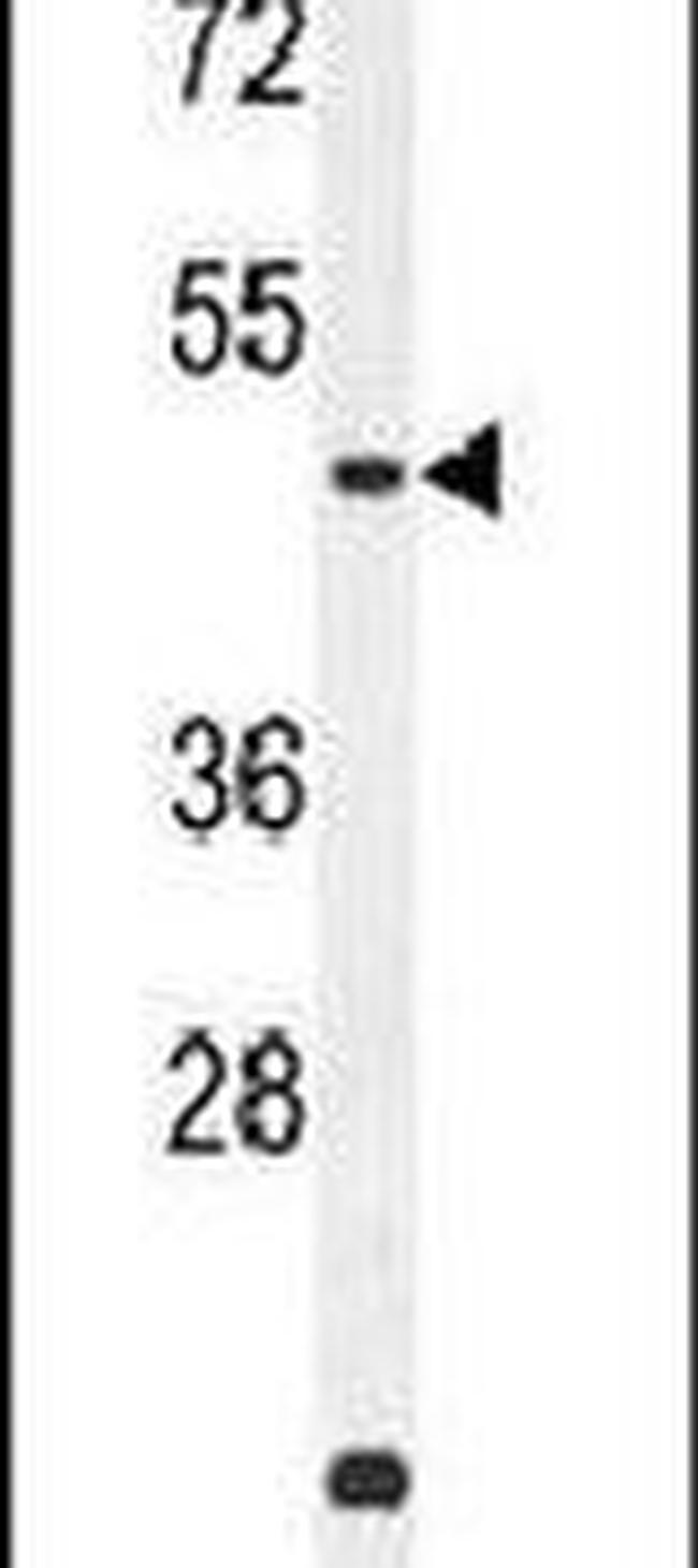 ZNF572 Antibody in Western Blot (WB)