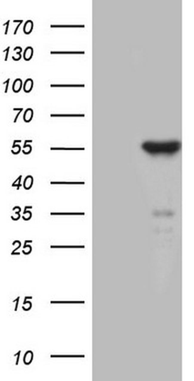 ZNF114 Antibody in Western Blot (WB)