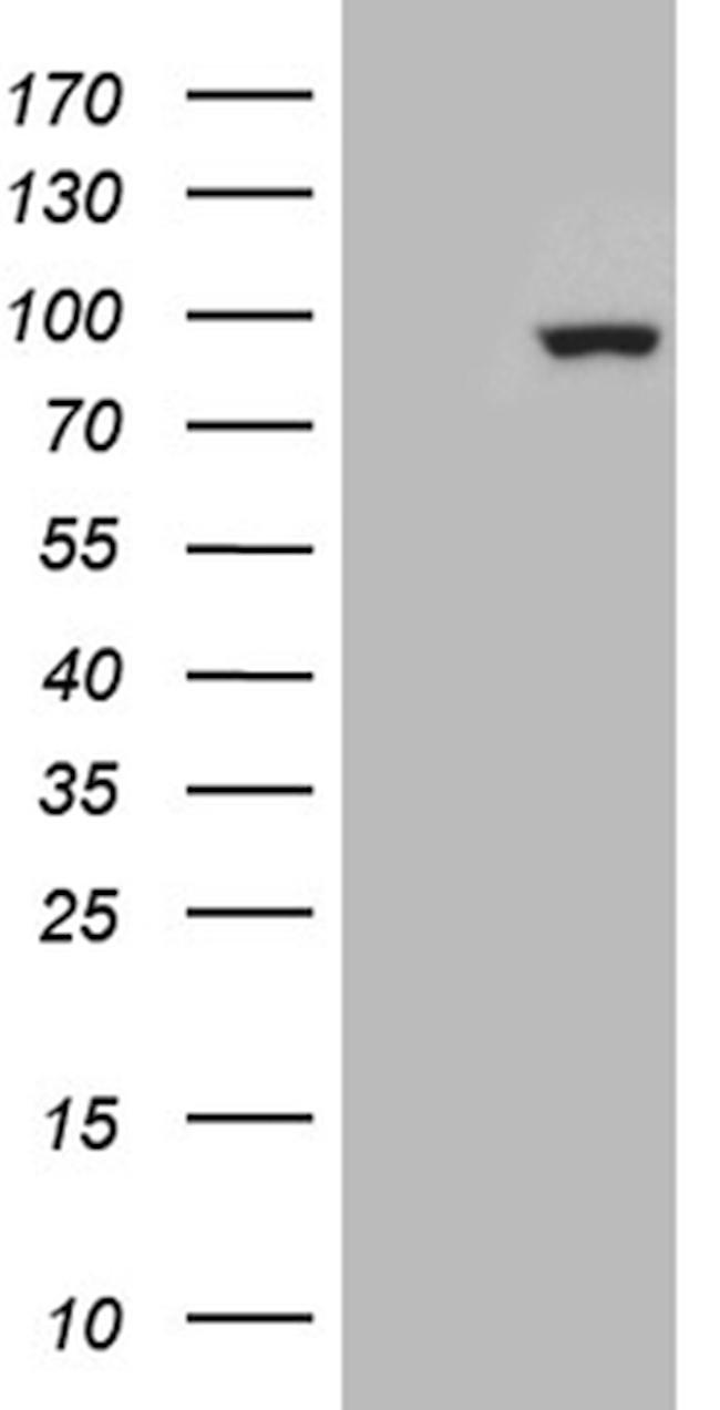 ZNF175 Antibody in Western Blot (WB)