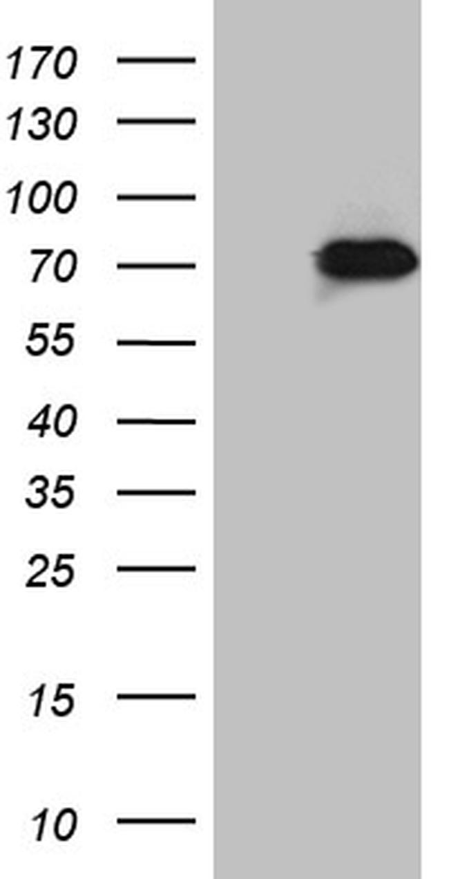 ZNF18 Antibody in Western Blot (WB)