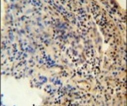 ZNF197 Antibody in Immunohistochemistry (IHC)