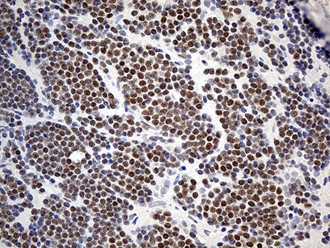 ZNF2 Antibody in Immunohistochemistry (Paraffin) (IHC (P))