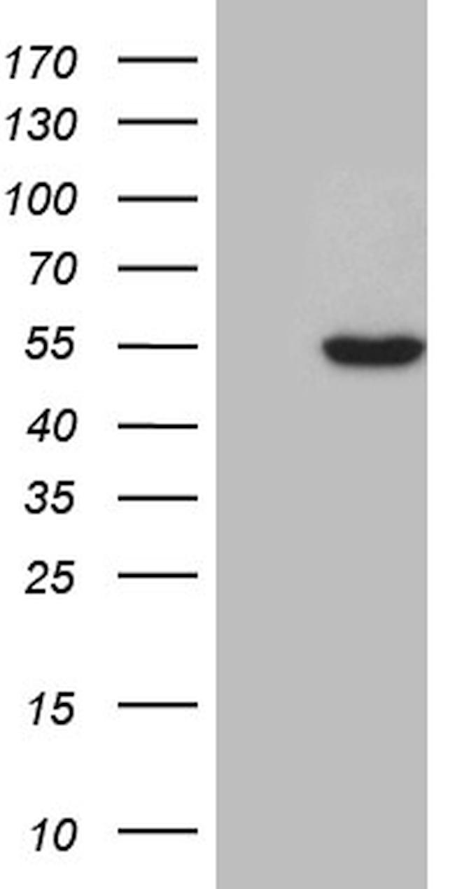 ZNF2 Antibody in Western Blot (WB)