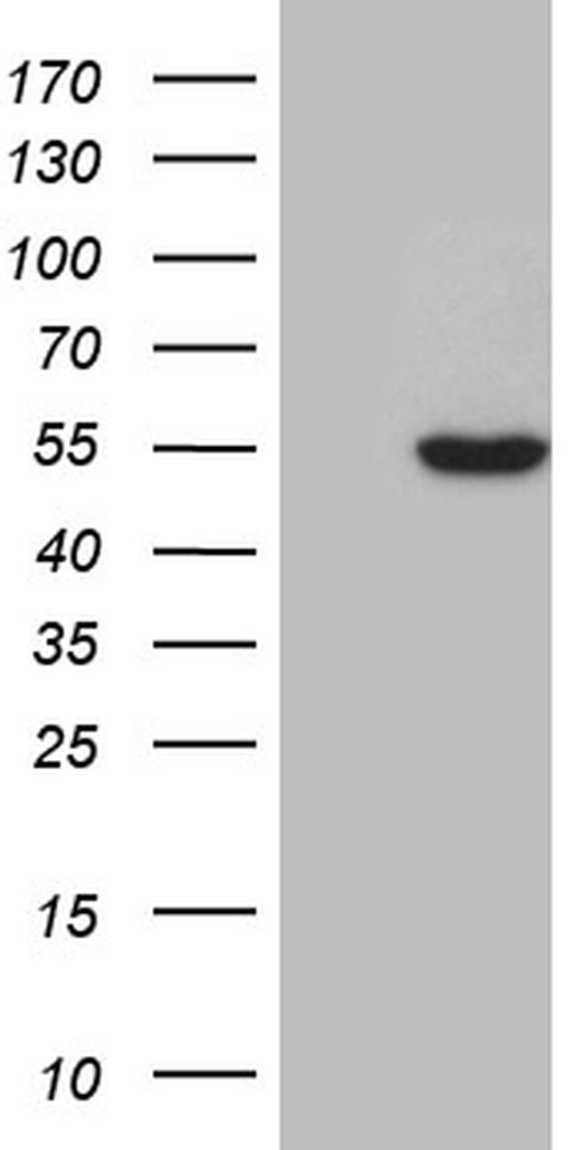 ZNF2 Antibody in Western Blot (WB)