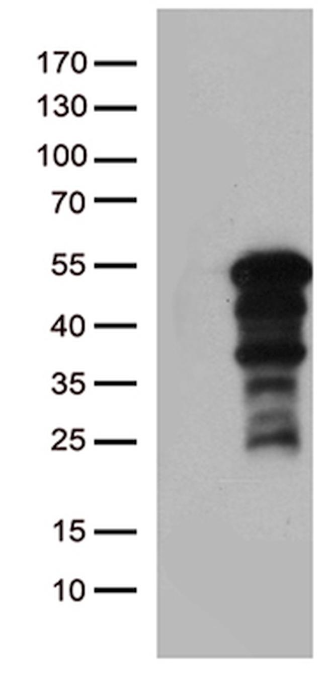 ZNF2 Antibody in Western Blot (WB)