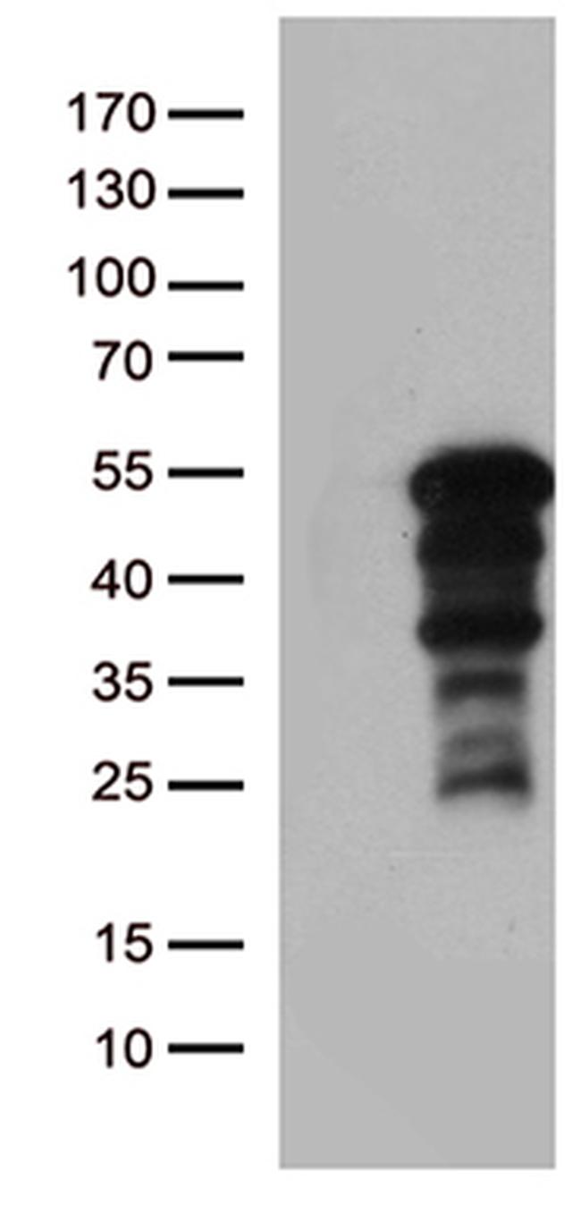 ZNF2 Antibody in Western Blot (WB)