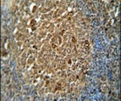 ZNF20 Antibody in Immunohistochemistry (IHC)
