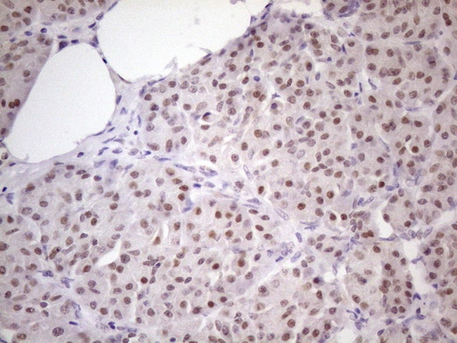 ZNF200 Antibody in Immunohistochemistry (Paraffin) (IHC (P))