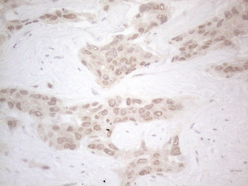 ZNF200 Antibody in Immunohistochemistry (Paraffin) (IHC (P))