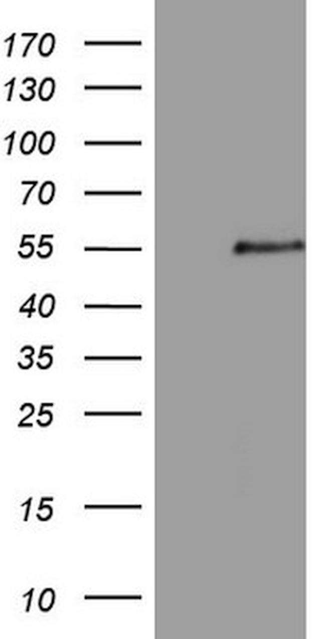 ZNF200 Antibody in Western Blot (WB)