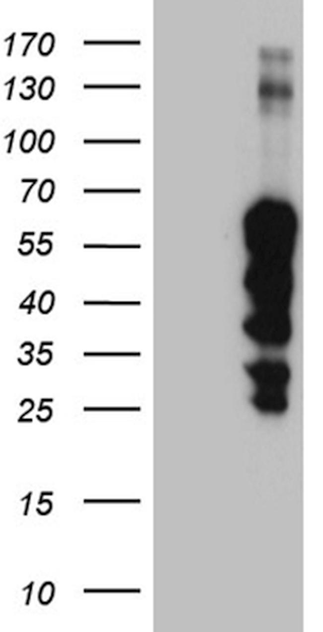ZNF213 Antibody in Western Blot (WB)