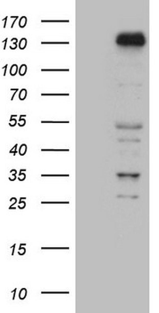 ZNF217 Antibody in Western Blot (WB)