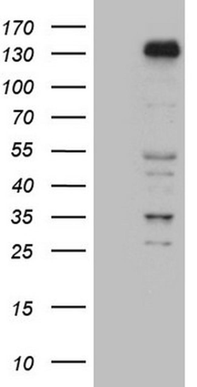 ZNF217 Antibody in Western Blot (WB)