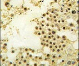 ZNF219 Antibody in Immunohistochemistry (IHC)