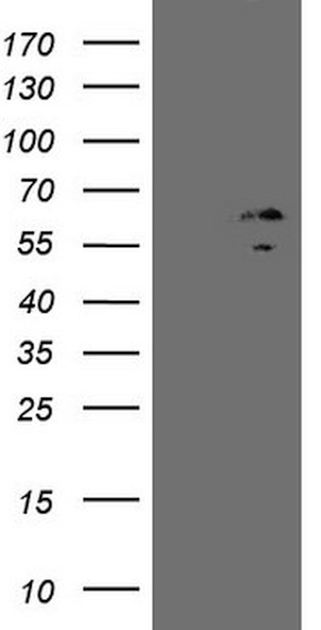 ZNF230 Antibody in Western Blot (WB)