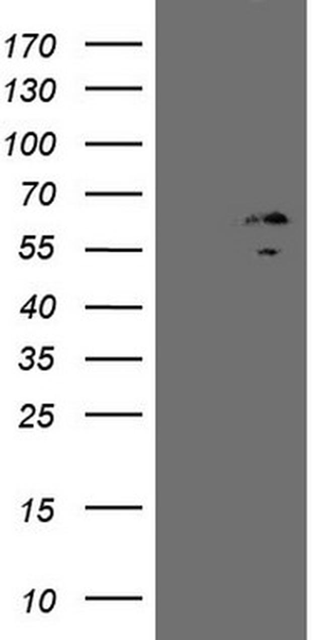 ZNF230 Antibody in Western Blot (WB)