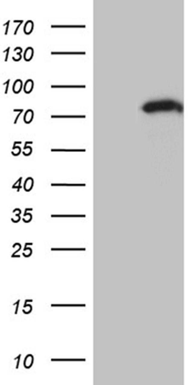 ZNF264 Antibody in Western Blot (WB)