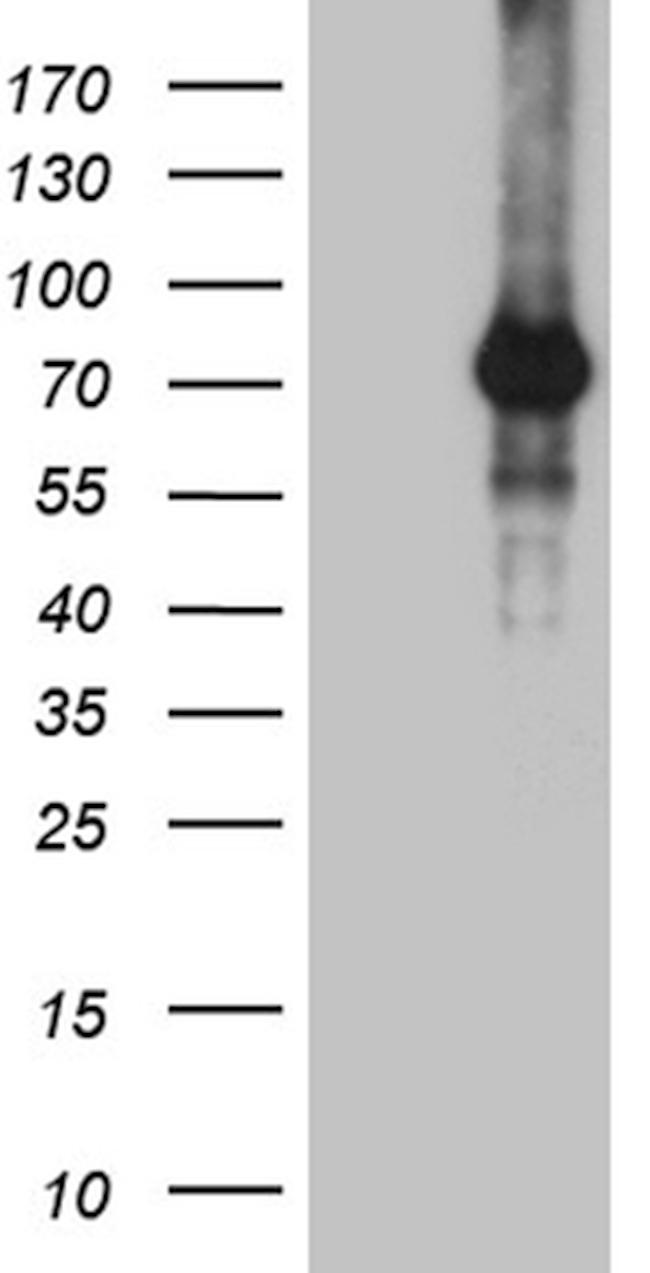 ZNF264 Antibody in Western Blot (WB)