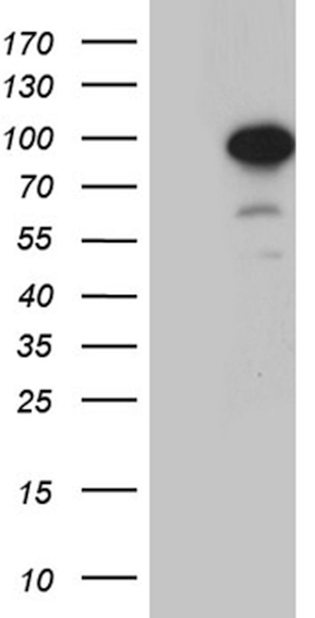 ZNF264 Antibody in Western Blot (WB)
