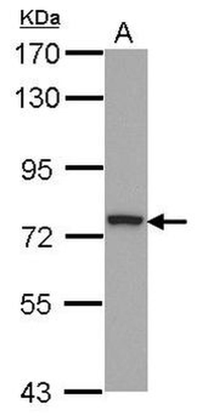 ZNF266 Antibody in Western Blot (WB)