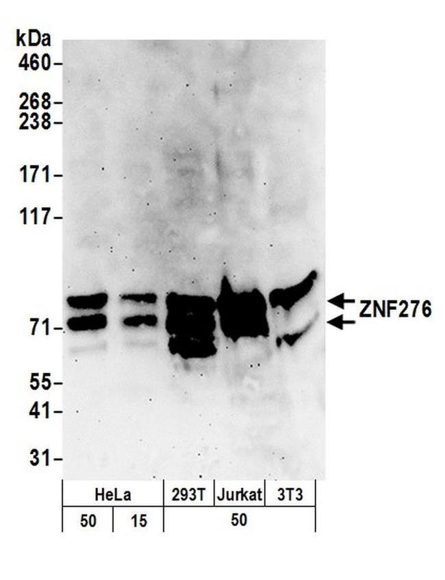 ZNF276 Antibody in Western Blot (WB)