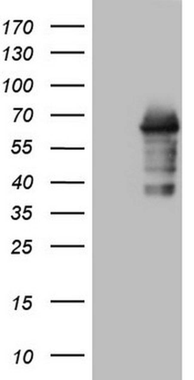 ZNF286A Antibody in Western Blot (WB)