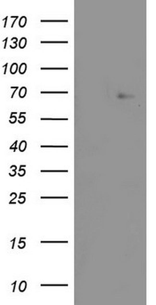 ZNF286A Antibody in Western Blot (WB)
