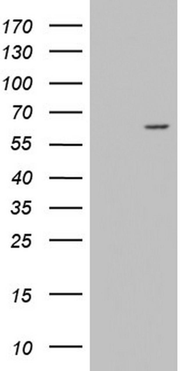 ZNF286A Antibody in Western Blot (WB)