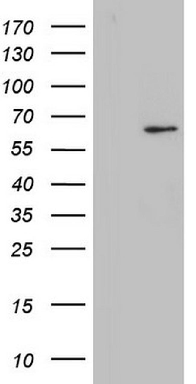 ZNF286A Antibody in Western Blot (WB)