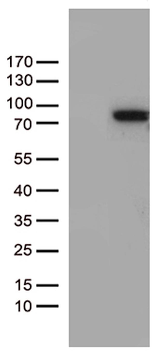 ZNF317 Antibody in Western Blot (WB)