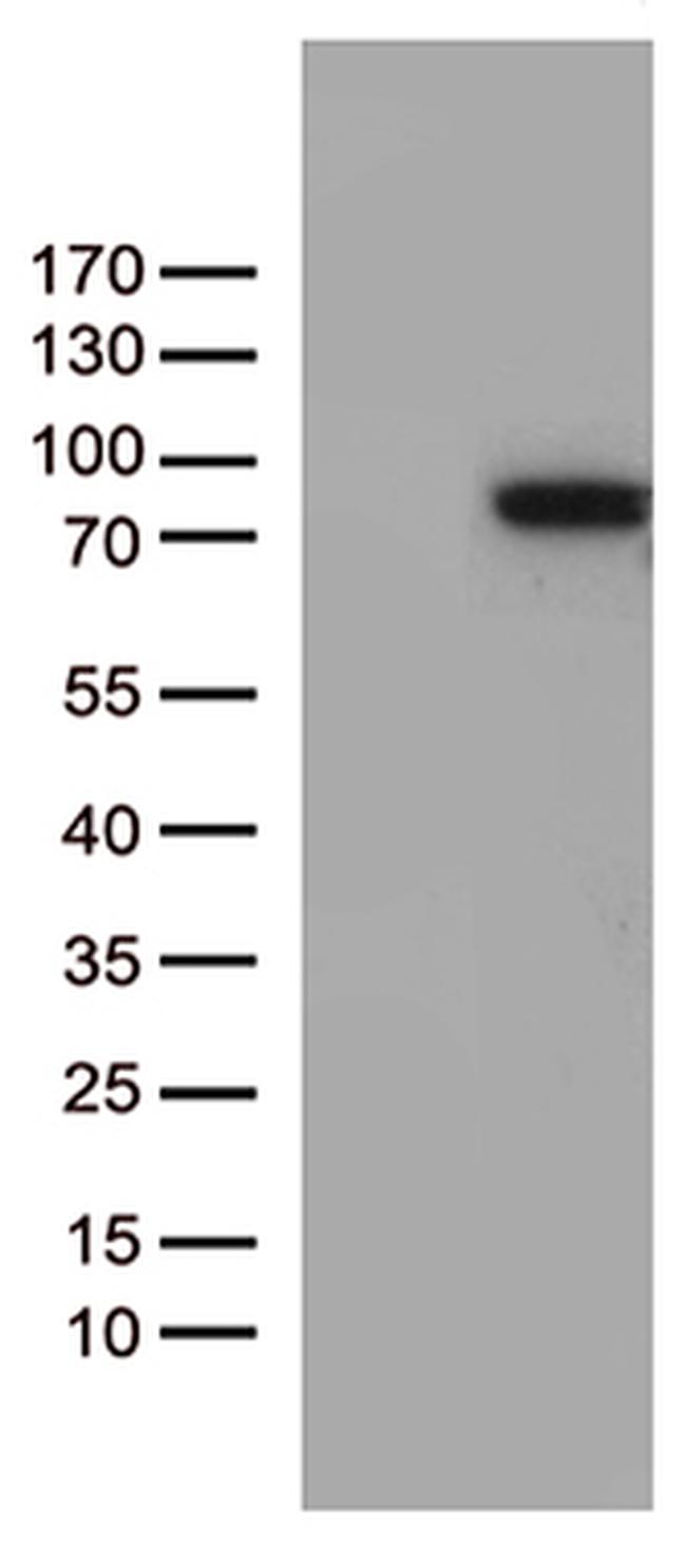 ZNF317 Antibody in Western Blot (WB)