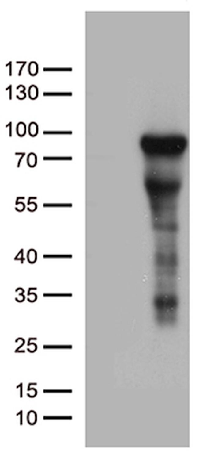 ZNF317 Antibody in Western Blot (WB)