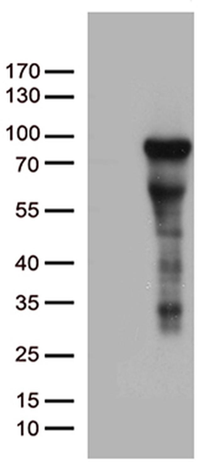 ZNF317 Antibody in Western Blot (WB)