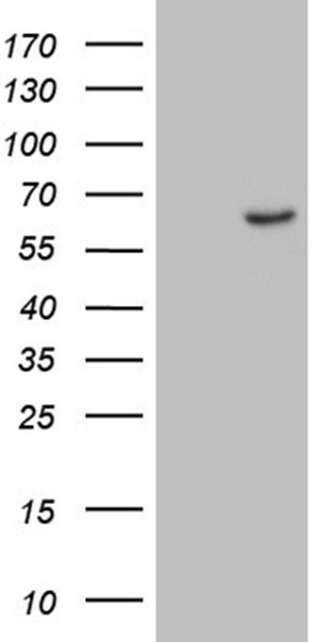 ZNF329 Antibody in Western Blot (WB)