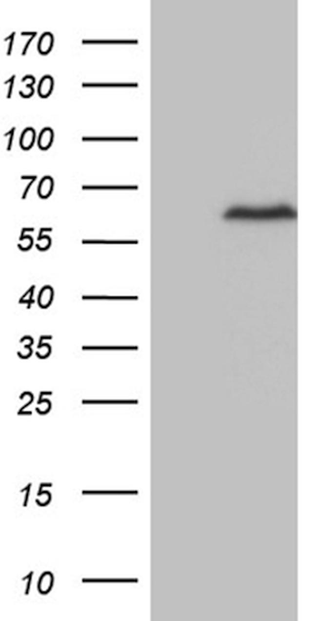 ZNF329 Antibody in Western Blot (WB)