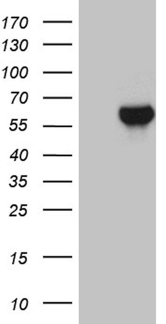 ZNF329 Antibody in Western Blot (WB)
